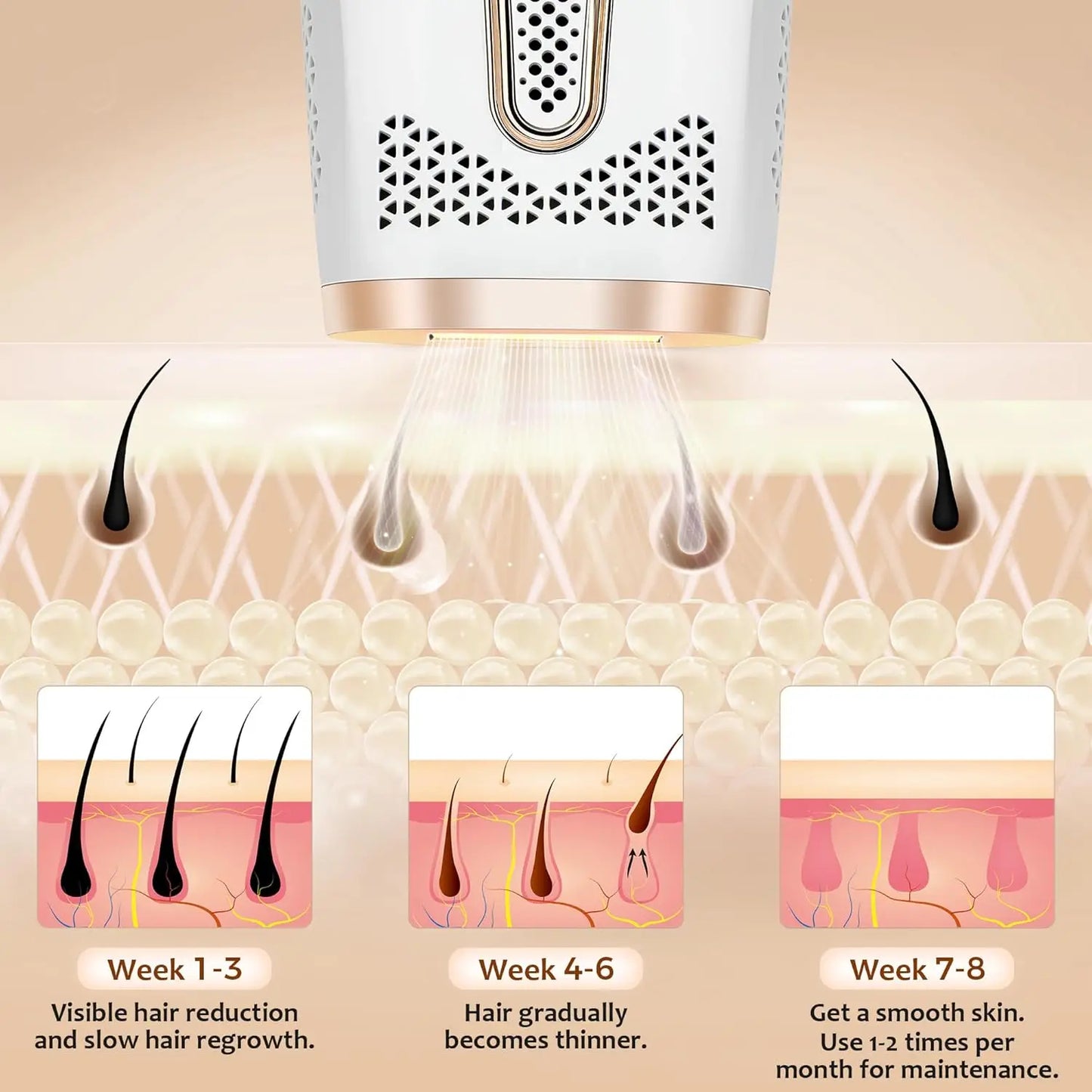 IPL Laser Hair Removal