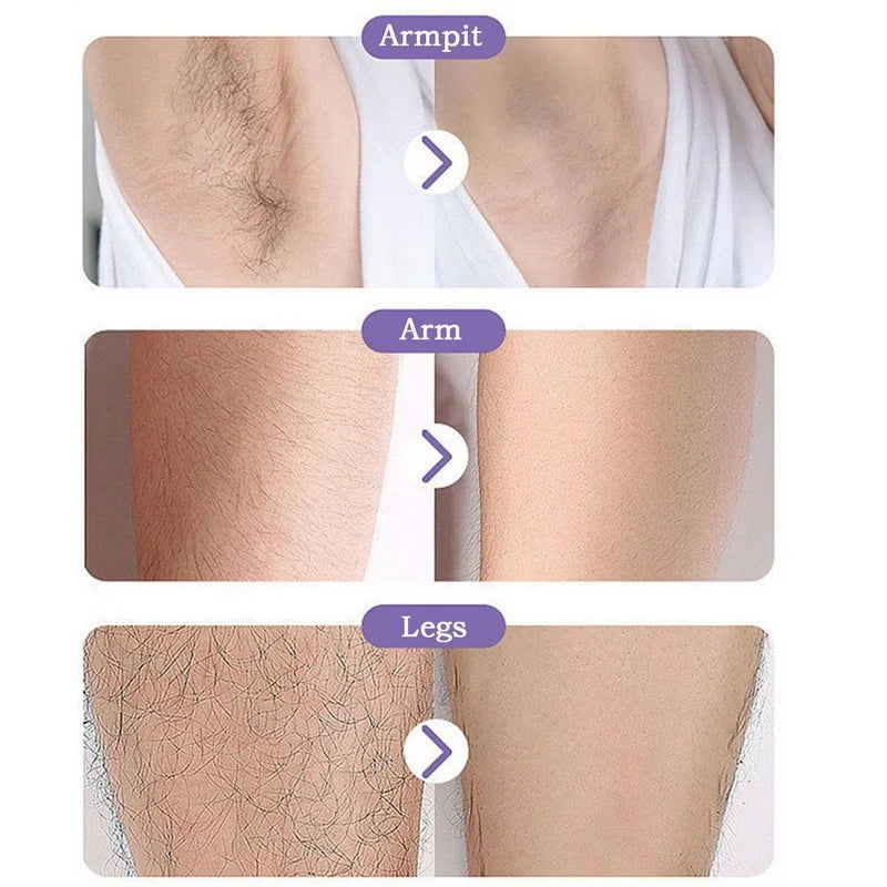 Crystal Hair Removal Device