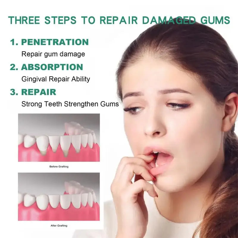 Gum Relief Drops